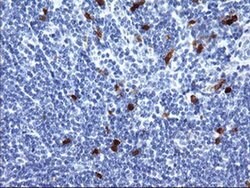SERPINB2 Monoclonal Antibody (OTI3H1), TrueMAB , OriGene 30 &mu;L; Unconjugated:Antibodies,