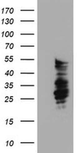 SERPINB2 Mouse anti-Human, Clone: OTI1F6, liquid, TrueMAB 100 &mu;L; Unconjugated:Antibodies,
