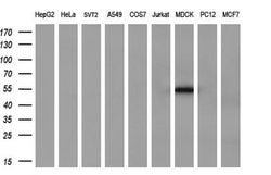 SERPINB2 Mouse anti-Human, Clone: OTI1F6, liquid, TrueMAB 100 &mu;L; Unconjugated:Antibodies,