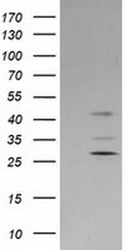 SERPINB2 Monoclonal Antibody (OTI4A3), TrueMAB , OriGene 100 &mu;L; Unconjugated:Antibodies,