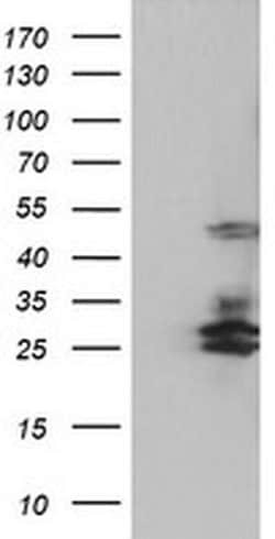 SERPINB2 Monoclonal Antibody (OTI4E6), TrueMAB , OriGene 30 &mu;L; Unconjugated:Antibodies,