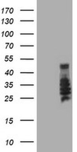 SERPINB2 Monoclonal Antibody (OTI3H1), TrueMAB , OriGene:Antibodies:Primary
