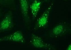 SERPINB3 Mouse anti-Human, Clone: OTI3G4, liquid, TrueMAB 100 &mu;L; Unconjugated:Antibodies,