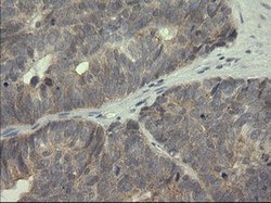 SERPINB3 Mouse anti-Canine, Human, Rat, Clone: OTI3C2, lyophilized, TrueMAB