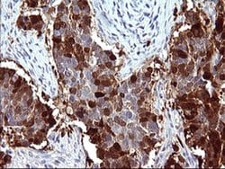 SERPINB3 Monoclonal Antibody (OTI1C10), TrueMAB , OriGene:Antibodies:Primary