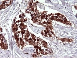 SERPINB3 Monoclonal Antibody (OTI1C10), TrueMAB , OriGene 100 &mu;L; Unconjugated:Antibodies,