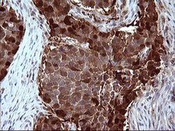 SERPINB3 Monoclonal Antibody (OTI1A5), TrueMAB , OriGene 100 &mu;L; Unconjugated:Antibodies,