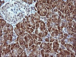 SERPINB3 Monoclonal Antibody (OTI1A5), TrueMAB , OriGene 100 &mu;L; Unconjugated:Antibodies,