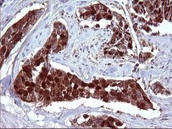 SERPINB3 Monoclonal Antibody (OTI1A5), TrueMAB , OriGene 100 &mu;L; Unconjugated:Antibodies,