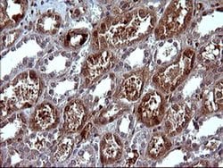 SERPINB3 Monoclonal Antibody (OTI1A5), TrueMAB , OriGene 100 &mu;L; Unconjugated:Antibodies,