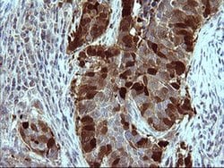 SERPINB3 Monoclonal Antibody (OTI1G5), TrueMAB , OriGene 100 &mu;L; Unconjugated:Antibodies,