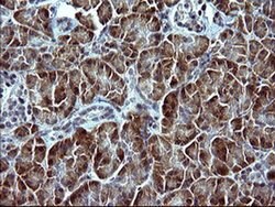 SERPINB3 Monoclonal Antibody (OTI1G5), TrueMAB , OriGene 100 &mu;L; Unconjugated:Antibodies,