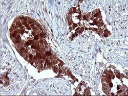 SERPINB3 Monoclonal Antibody (OTI1G5), TrueMAB , OriGene 100 &mu;L; Unconjugated:Antibodies,