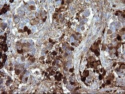 SERPINB3 Monoclonal Antibody (OTI1G9), TrueMAB , OriGene 30 &mu;L; Unconjugated:Antibodies,