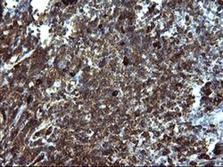 SERPINB3 Monoclonal Antibody (OTI1G9), TrueMAB , OriGene 30 &mu;L; Unconjugated:Antibodies,