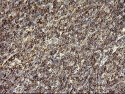 SERPINB3 Mouse anti-Human, Clone: OTI1G9, lyophilized, TrueMAB 100 &mu;g;