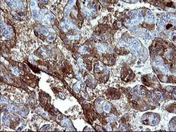 SERPINB3 Monoclonal Antibody (OTI1G9), TrueMAB , OriGene 30 &mu;L; Unconjugated:Antibodies,