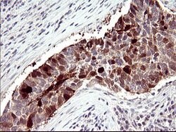 SERPINB3 Mouse anti-Human, Clone: OTI2B11, lyophilized, TrueMAB 100 &mu;g;