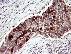 SERPINB3 Monoclonal Antibody (OTI2B11), TrueMAB , OriGene 100 &mu;L | Buy Online | Origene Technologies | Fisher Scientific