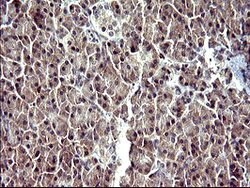 SERPINB3 Mouse anti-Human, Clone: OTI2B11, lyophilized, TrueMAB 100 &mu;g;