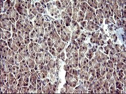 SERPINB3 Monoclonal Antibody (OTI2B11), TrueMAB , OriGene 100 &mu;L | Buy Online | Origene Technologies | Fisher Scientific