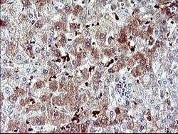 SERPINB3 Mouse anti-Human, Clone: OTI2B11, lyophilized, TrueMAB 100 &mu;g;
