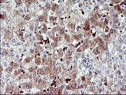 SERPINB3 Monoclonal Antibody (OTI2B11), TrueMAB , OriGene 100 &mu;L | Buy Online | Origene Technologies | Fisher Scientific