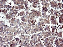 SERPINB3 Mouse anti-Human, Clone: OTI2B11, lyophilized, TrueMAB 100 &mu;g;