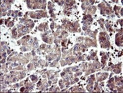 SERPINB3 Monoclonal Antibody (OTI2B11), TrueMAB , OriGene 100 &mu;L | Buy Online | Origene Technologies | Fisher Scientific