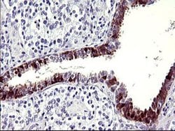 SERPINB3 Monoclonal Antibody (OTI1F10), TrueMAB , OriGene 100 &mu;L; Unconjugated:Antibodies,