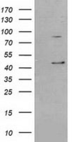 SERPINB3 Mouse anti-Canine, Human, Rat, Clone: OTI3C2, lyophilized, TrueMAB