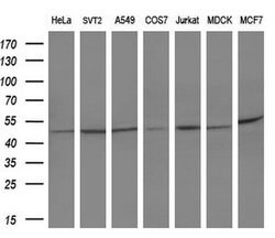 SERPINB3 Monoclonal Antibody (OTI1C10), TrueMAB , OriGene 100 &mu;L; Unconjugated:Antibodies,