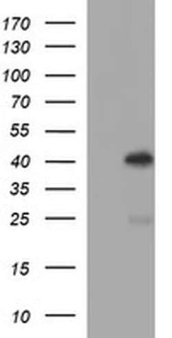SERPINB3 Monoclonal Antibody (OTI1A5), TrueMAB , OriGene 100 &mu;L; Unconjugated:Antibodies,