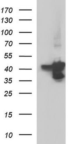 SERPINB3 Monoclonal Antibody (OTI1C12), TrueMAB , OriGene:Antibodies:Primary
