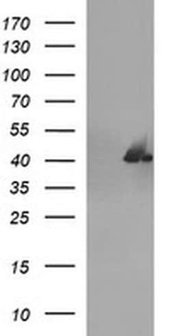 SERPINB3 Monoclonal Antibody (OTI1A10), TrueMAB , OriGene 100 &mu;L; Unconjugated:Antibodies,