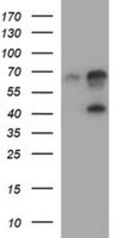 SERPINB3 Mouse anti-Human, Clone: OTI1G9, lyophilized, TrueMAB 100 &mu;g;