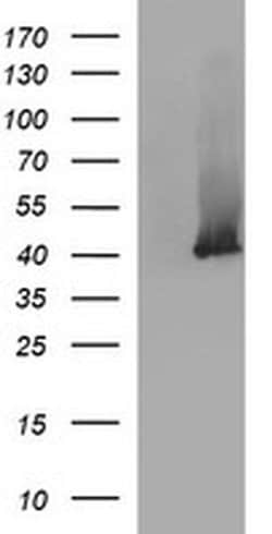 SERPINB3 Monoclonal Antibody (OTI1F10), TrueMAB , OriGene:Antibodies:Primary