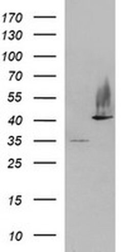 SERPINB3 Monoclonal Antibody (OTI2B9), TrueMAB , OriGene:Antibodies:Primary