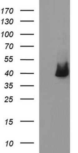 SERPINB3 Mouse anti-Human, Clone: OTI3G4, lyophilized, TrueMAB 100 &mu;g;