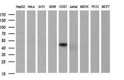 SERPINB3 Mouse anti-Human, Clone: OTI3G4, lyophilized, TrueMAB 100 &mu;g;