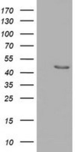 SERPINB4 Mouse anti-Human, Clone: OTI2B9, lyophilized, TrueMAB 100 &mu;g;