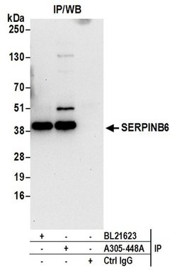 SERPINB6 Rabbit anti-Human, Polyclonal, Bethyl Laboratories 100 &mu;L;