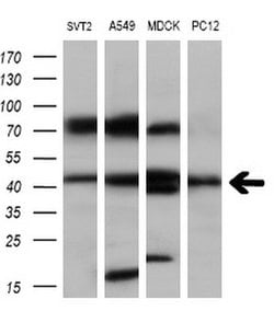 SERPINB6 Monoclonal Antibody (OTI2F8), TrueMAB , OriGene 30 &mu;L; Unconjugated:Antibodies,