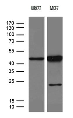 SERPINB8 Monoclonal Antibody (OTI9B2), TrueMAB , OriGene 100 &mu;L; Unconjugated:Antibodies,