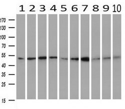 SERPINC1 Mouse anti-Human, Clone: OTI8D5, liquid, TrueMAB 100 &mu;L; Unconjugated:Antibodies,