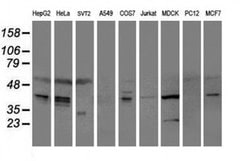 SERPINE2 Monoclonal Antibody (OTI4E4), TrueMAB , OriGene 30 &mu;L; Unconjugated:Antibodies,
