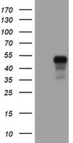 SERPINE2 Monoclonal Antibody (OTI6F3), TrueMAB , OriGene 100 &mu;L; Unconjugated:Antibodies,