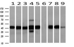 SERPINE2 Monoclonal Antibody (OTI6F3), TrueMAB , OriGene 100 &mu;L; Unconjugated:Antibodies,