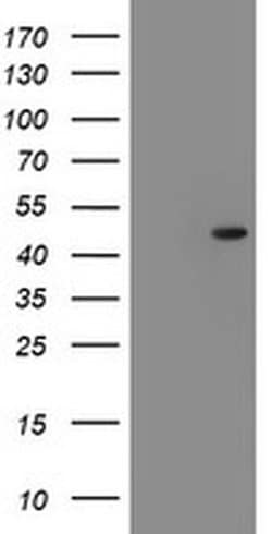 SERPINF1 Monoclonal Antibody (OTI1F7), TrueMAB , OriGene:Antibodies:Primary