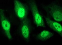 SESTD1 Monoclonal Antibody (OTI2E7), TrueMAB , OriGene 100 &mu;L; Unconjugated:Antibodies,